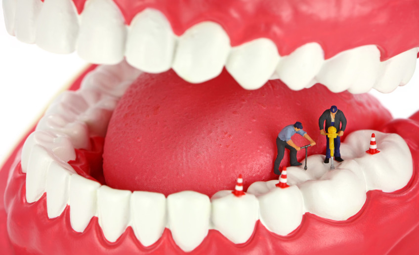 مراقبت های عصب کشی دندان