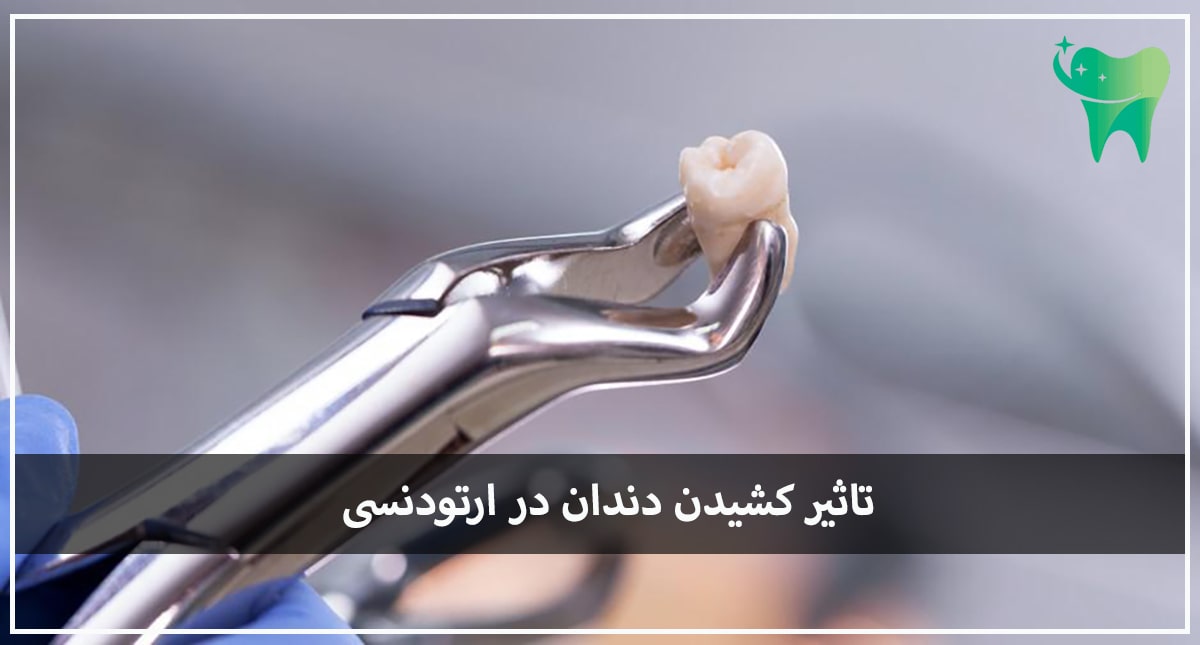 تاثیر کشیدن دندان بر ارتودنسی